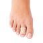 ORTMANN 3504-002 Защитное кольцо ORTMANN Тодес (Todes)